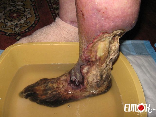 Ca sent les pieds, là ???